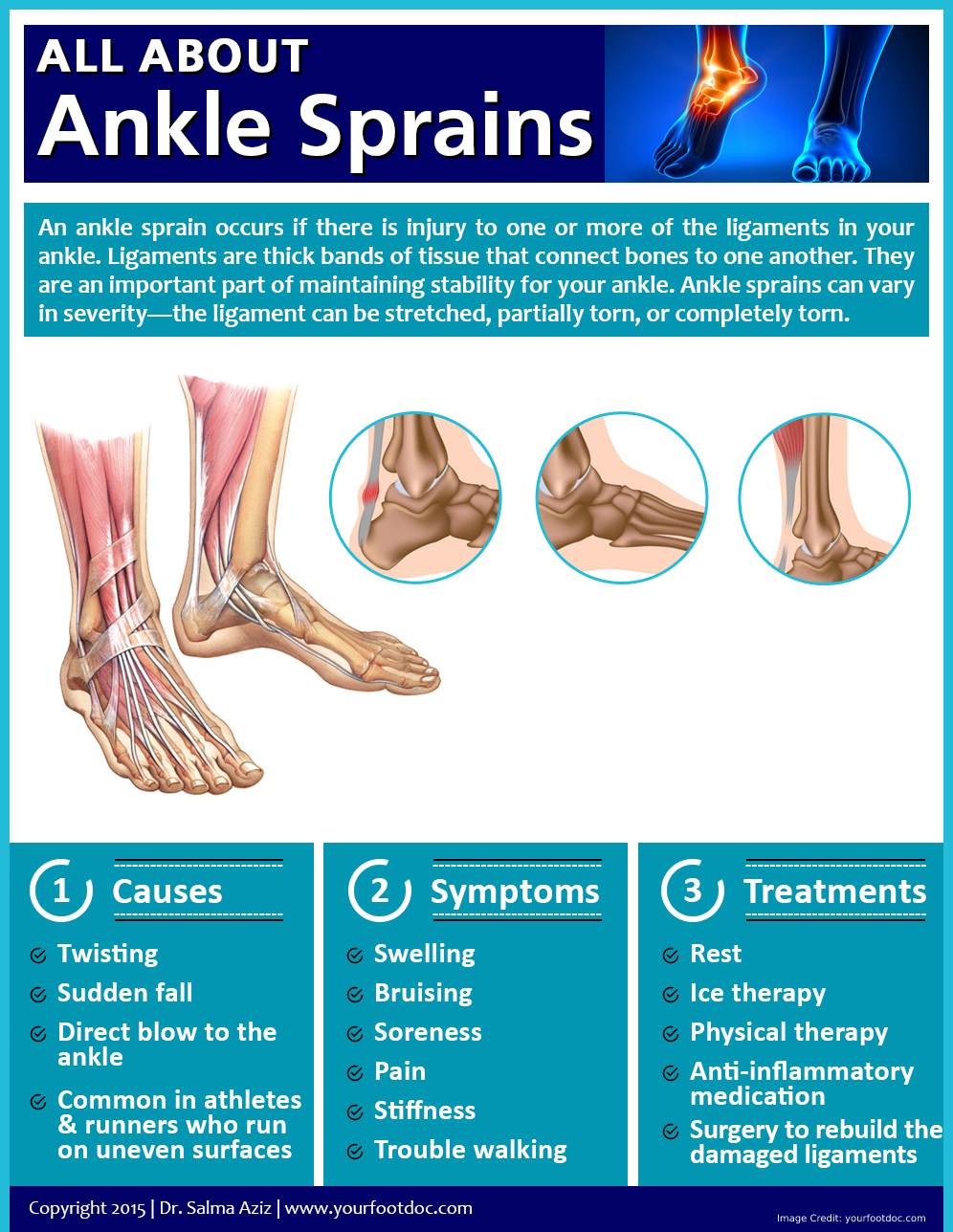 Chronic Ankle Joint Pain What Causes Chronic Ankle