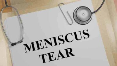 All You Should Know About A Meniscus Injury