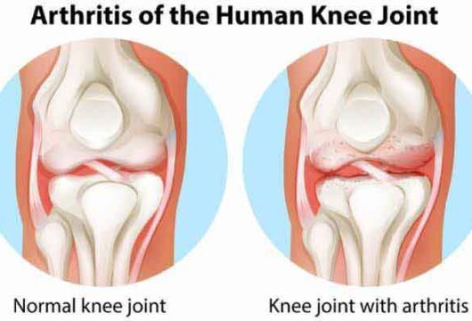 The #22 Different Types of Joint Pain You Must Know