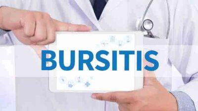 11 Effective Home Remedies To Get Rid of Bursitis