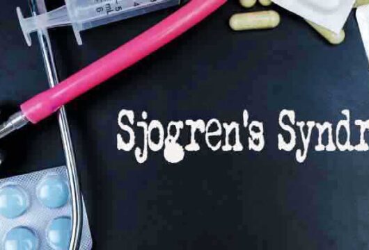 Take A Closer Look At Sjogren’s Syndrome