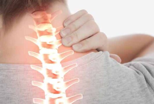 Arthritis In Neck – How Can You Prevent Neck Arthritis?