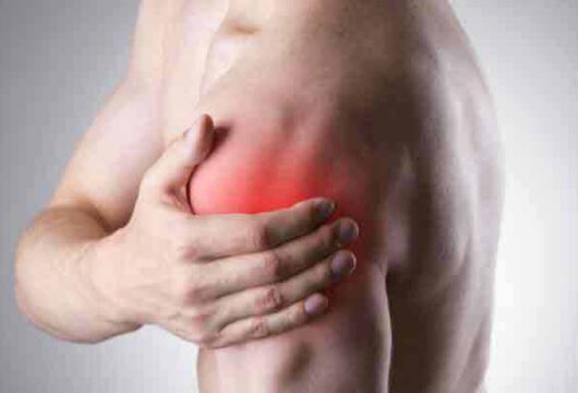 Shoulder Arthritis: Types of Arthritis That Affect the Shoulder