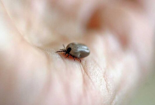 How to Treat Joint Pain Caused By Lyme Disease