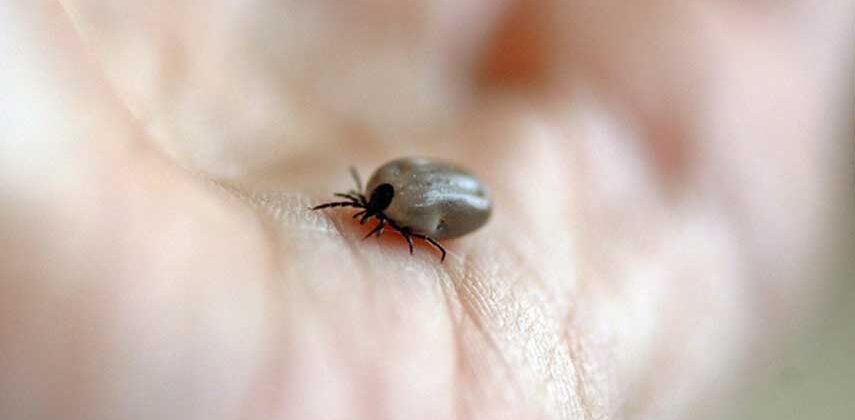 How to Treat Joint Pain Caused By Lyme Disease